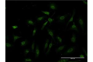 Immunofluorescence (IF) image for anti-Inhibitor of kappa Light Polypeptide Gene Enhancer in B-Cells, Kinase beta (IKBKB) (AA 3-120) antibody (ABIN516987)