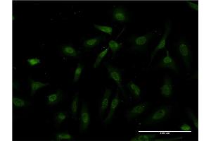 Immunofluorescence of monoclonal antibody to IKBKB on HeLa cell. (IKBKB antibody  (AA 3-120))