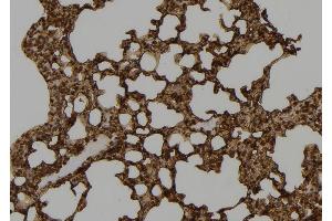 ABIN6277493 at 1/100 staining Mouse lung tissue by IHC-P. (SETD8 antibody  (Internal Region))