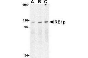 Western blot analysis of IRE1p in A-20 cell lysate with AP30444PU-N IRE1p antibody at (A), 0. (ERN1 antibody  (C-Term))