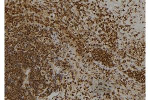 ABIN6266445 at 1/100 staining Human spleen tissue by IHC-P. (CAPG antibody  (Internal Region))