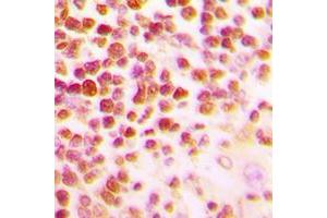 Immunohistochemical analysis of c-Myb staining in human tonsil formalin fixed paraffin embedded tissue section. (MYB antibody  (N-Term))