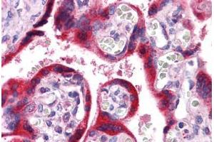 Human Placenta: Formalin-Fixed, Paraffin-Embedded (FFPE) (ATP6V1D antibody  (AA 69-169))