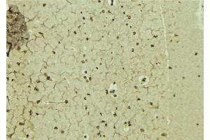 Immunohistochemistry (IHC) image for anti-Nuclear Receptor Subfamily 0, Group B, Member 1 (NR0B1) (Internal Region) antibody (ABIN6263711)