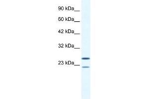 WB Suggested Anti-TRIM14 Antibody Titration:  0. (TRIM14 antibody  (N-Term))