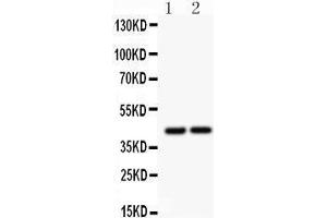 Anti- RUNX3 antibody, Western blotting All lanes: Anti RUNX3  at 0. (RUNX3 antibody  (Middle Region))