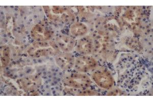 Immunohistochemistry of paraffin-embedded Rat kidney using PDGFRB Polyclonal Antibody at dilution of 1:50 (PDGFRB antibody)