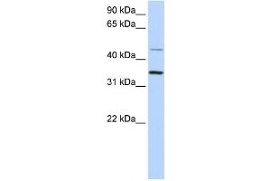 Western Blotting (WB) image for anti-Ceroid-Lipofuscinosis, Neuronal 6, Late Infantile, Variant (CLN6) antibody (ABIN2459098) (CLN6 antibody)