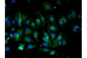 Validation submitted by One World Lab. (COX IV antibody  (AA 51-169))