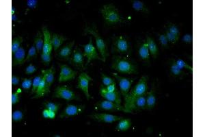 Validation submitted by One World Lab. (COX IV antibody  (AA 51-169))