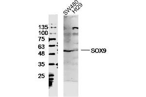 SW480 and Ht29 lysates probed with SOX9 Polyclonal Antibody, unconjugated  at 1:300 overnight at 4°C followed by a conjugated secondary antibody at 1:10000 for 90 minutes at 37°C. (SOX9 antibody  (AA 121-220))