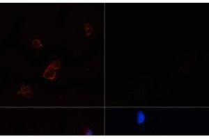 Immunofluorescence analysis of 293T cells using ACACA Polyclonal Antibody at dilution of 1:100. (Acetyl-CoA Carboxylase alpha antibody)