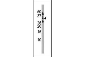 The anti-Phospho-CDK1-S39 Pab (ABIN389538 and ABIN2839585) is used in Western blot for detection in Ramos tissue lysate. (CDK1 antibody  (pSer39))