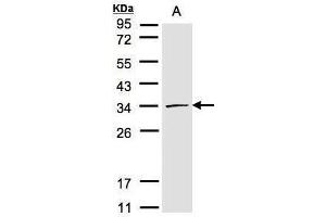 CDK4 antibody