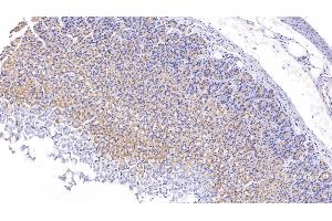 Immunohistochemistry (IHC) image for anti-Nuclear Receptor Subfamily 1, Group H, Member 4 (NR1H4) (AA 375-568) antibody (ABIN7440740)