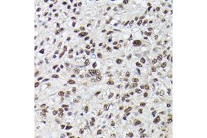 Immunohistochemistry of paraffin-embedded Human lung using SRSF2 antibody (ABIN1682677, ABIN3017915, ABIN3017916, ABIN5664377 and ABIN6220303) at dilution of 1:100 (40x lens).