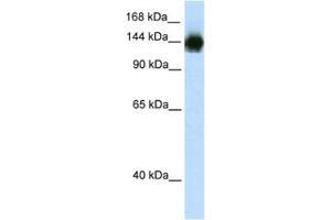 Western Blotting (WB) image for anti-Timeless Homolog (TIMELESS) antibody (ABIN2461712)