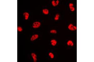 Immunofluorescent analysis of Estrogen Receptor alpha (pS106) staining in MCF7 cells. (Estrogen Receptor alpha antibody  (pSer106))