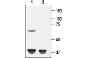 Western blot analysis of rat cortex lysate: - 1. (KCNJ8 antibody  (C-Term, Intracellular))
