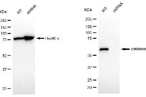 Western blotting analysis using catalase antibody (ABIN7797919). (Recombinant Catalase antibody)