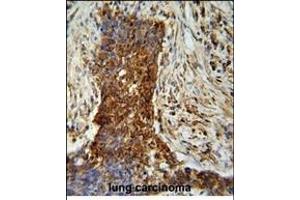 Immunohistochemistry (Paraffin-embedded Sections) (IHC (p)) image for anti-Matrix Metalloproteinase 2 (MMP2) antibody (ABIN659015)