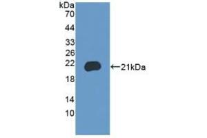 Detection of Recombinant BRD8, Mouse using Polyclonal Antibody to Bromodomain Containing Protein 8 (BRD8) (BRD8 antibody  (AA 797-951))