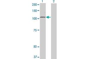 Western Blot analysis of TLR8 expression in transfected 293T cell line by TLR8 monoclonal antibody (M01), clone 4C6. (TLR8 antibody  (AA 723-825))