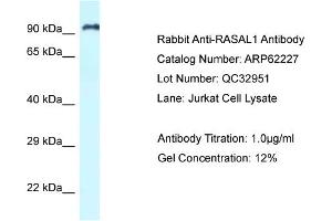 Western Blotting (WB) image for anti-RAS Protein Activator Like 1 (GAP1 Like) (RASAL1) (C-Term) antibody (ABIN2789073)