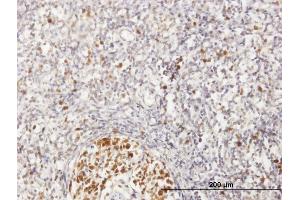 Immunoperoxidase of purified MaxPab antibody to MCM6 on formalin-fixed paraffin-embedded human lymph node. (MCM6 antibody  (AA 1-821))