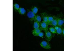 IF analysis of CD59 using anti-CD59 antibody (ABIN3043396). (CD59 antibody  (AA 26-102))