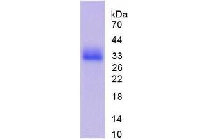 SDS-PAGE analysis of Mouse CDK1 Protein.