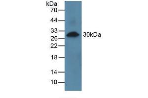 Western blot analysis of recombinant Human PRCP. (PRCP antibody  (AA 108-376))