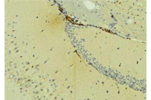 ABIN6275406 at 1/100 staining Mouse brain tissue by IHC-P.