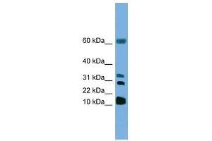 Western Blot showing LTC4S antibody used at a concentration of 1. (LTC4S antibody  (N-Term))
