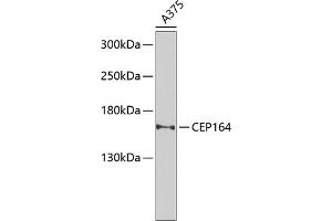 Western blot analysis of extracts of A-375 cells, using CEP164 Antibody (ABIN6131021, ABIN6138417, ABIN6138418 and ABIN6225304) at 1:1000 dilution. (CEP164 antibody  (AA 730-829))