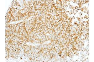 IHC-P Image Immunohistochemical analysis of paraffin-embedded PC13 xenograft, using EMR1, antibody at 1:100 dilution. (F4/80 antibody  (C-Term))