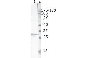 Western Blot testing of HIV-1 recombinant Nef protein. (HIV-1 Nef (AA 150-158) antibody)