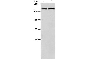 Western Blot analysis of Hela cell and Mouse lung tissue using PTCH1 Polyclonal Antibody at dilution of 1:900 (Patched 1 antibody)