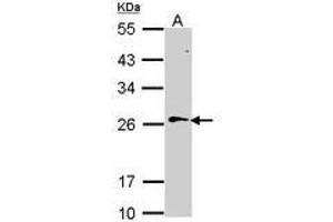 Image no. 2 for anti-RAN, Member RAS Oncogene Family (RAN) (AA 1-179) antibody (ABIN467626) (RAN antibody  (AA 1-179))