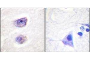 Immunohistochemistry (IHC) image for anti-Tyrosine Hydroxylase (TH) (AA 2-51), (pSer8) antibody (ABIN1531409)