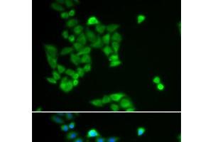 Immunofluorescence analysis of U2OS cells using PJA2 Polyclonal Antibody (PJA2 antibody)