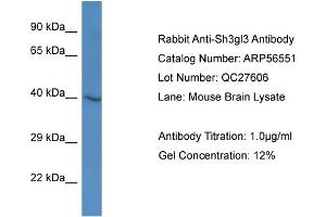Western Blotting (WB) image for anti-Endophilin-A3 (SH3GL3) (Middle Region) antibody (ABIN2786768)