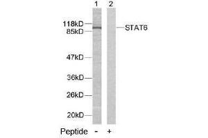 Image no. 2 for anti-Signal Transducer and Activator of Transcription 6, Interleukin-4 Induced (STAT6) (Tyr641) antibody (ABIN197184) (STAT6 antibody  (Tyr641))