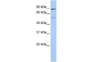 WB Suggested Anti-ESR1 Antibody Titration:  0. (Estrogen Receptor alpha antibody  (Middle Region))