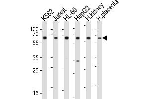 Western blot analysis of lysates from K562, Jurkat, HL-60, HepG2 cell line, human kidney, human placenta tissue(from left to right), using EPOR Antibody (C-term) (ABIN6243002 and ABIN6577698). (EPOR antibody  (C-Term))