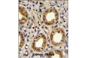 CXCR3 Antibody (Center) (ABIN654129 and ABIN2844003) immunohistochemistry analysis in formalin fixed and paraffin embedded human kidney tissue followed by peroxidase conjugation of the secondary antibody and DAB staining.