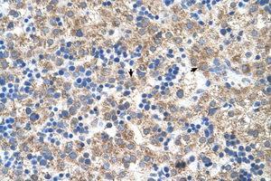 Image no. 1 for anti-Nuclear Receptor Subfamily 1, Group I, Member 3 (NR1I3) (N-Term) antibody (ABIN205086)