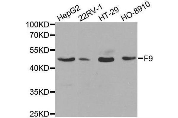 Coagulation Factor IX anticorps  (AA 29-192)