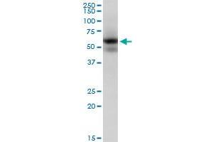 MAPK9 monoclonal antibody (M05), clone 1D6. (JNK2 antibody  (AA 321-424))