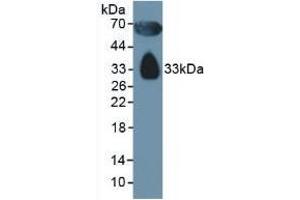Detection of APOD in Human Serum using Polyclonal Antibody to Apolipoprotein D (APOD) (Apolipoprotein D antibody  (AA 21-189))